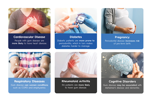 Association between periodontal disease and
systemic diseases.

