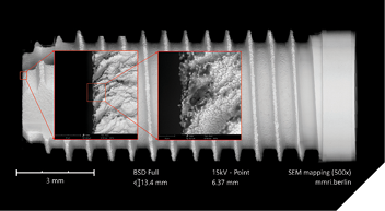 SEM image at 500x displays the implant shoulder of a new implant with significant plastic impurities. 
