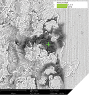  SEM images in 500x and 2,500x with EDS analysis result showing a fluorocarbon-based contamination (implant system from the USA).