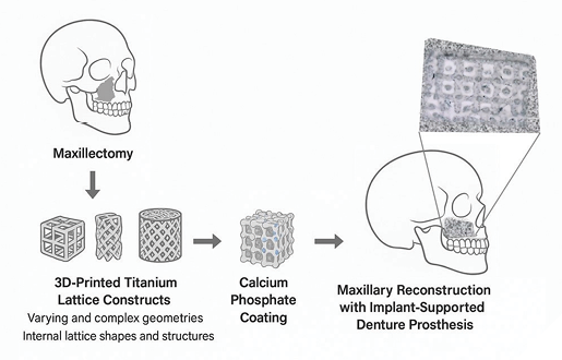 A schematic of the research program depicting a maxillectomy defect being reconstructed with 3D-printed titanium lattice constructs coated with calcium phosphate coatings to be ultimately restored with an implant-supported prosthesis.