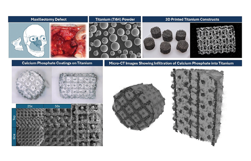 Images showing a maxillectomy surgical defect ; SEM of titanium powders ; 3D printed titanium constructs as printed and with calcium phosphate coatings ; and Micro-CT imaging showing calcium phosphate infiltration into the titanium lattice structure.