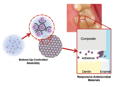 Product outline: Our self-assembly synthesis of porous antimicrobial loaded silica resulted in a tightly packed particle that releases antimicrobial over extended timeframes. Here, it is illustrated, being loaded into a restorative resin adhesive to prevent bacterial proliferation at the restoration margin.