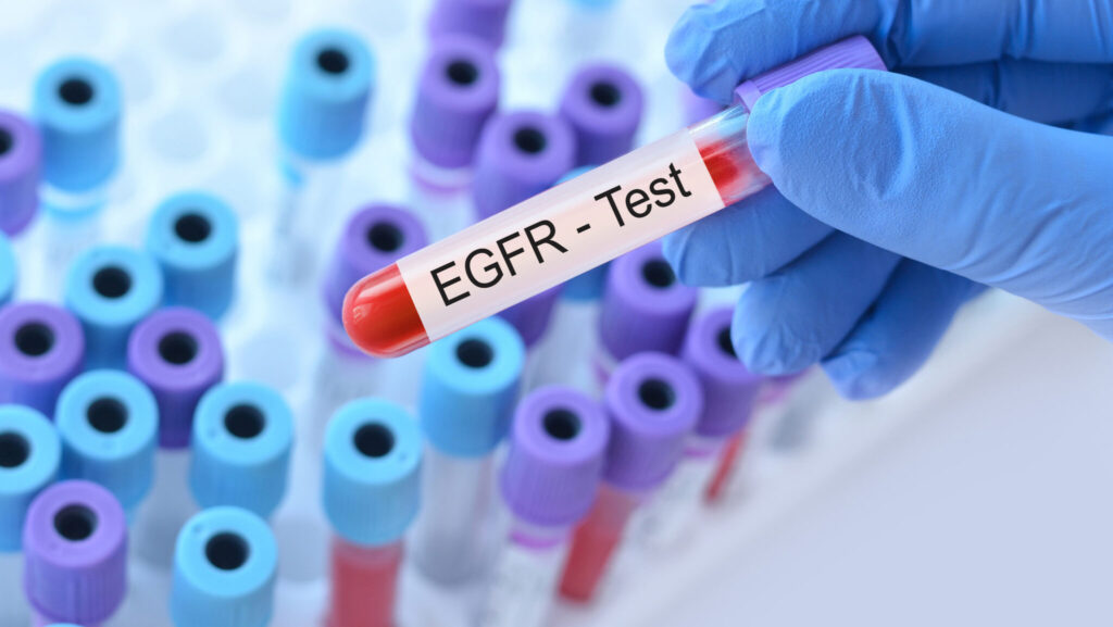 EGFR, a protein found on the surface of certain cells and involved in regulating cell growth and division, is overexpressed in most oral cancers. (iStock)