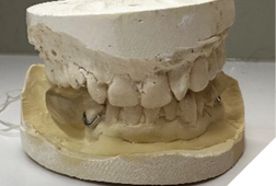 Gelb appliance on model.