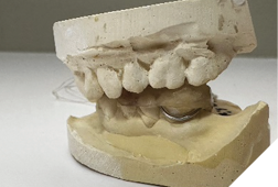 Gelb appliance on model.