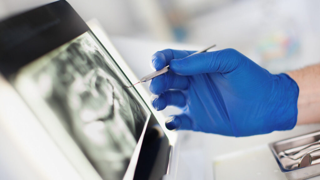 Advances in dental imaging — including cone beam computed tomography (CBCT) scanners and intraoral cameras — are reshaping diagnosis and treatment planning, according to the report. (iStock)