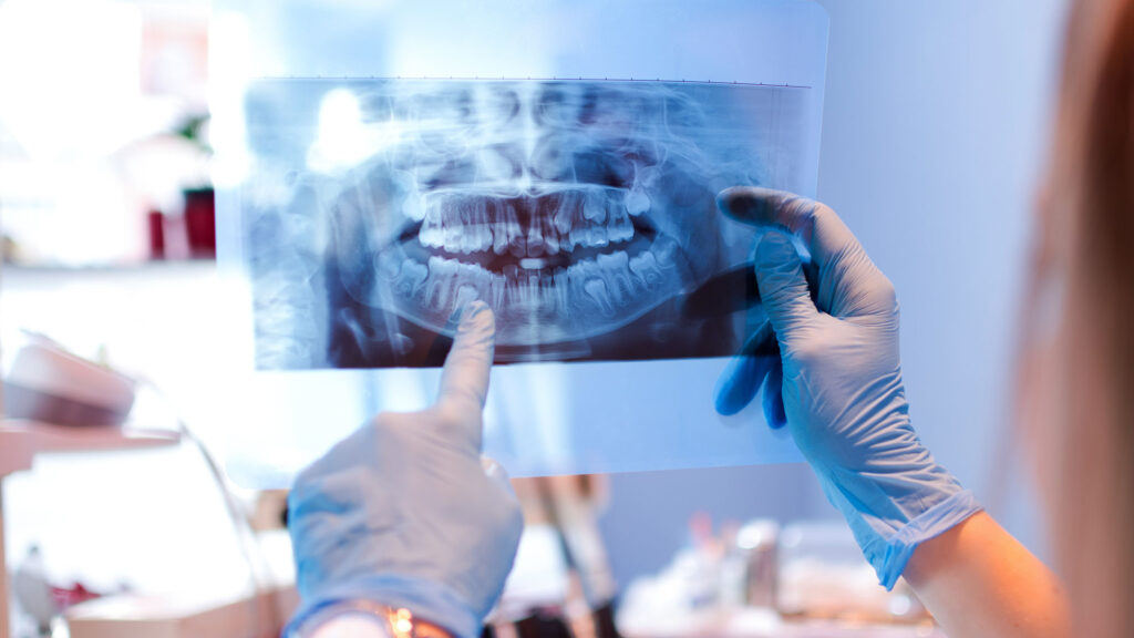 Teething Period – Cree dentistry working to expand community care. (iStock)