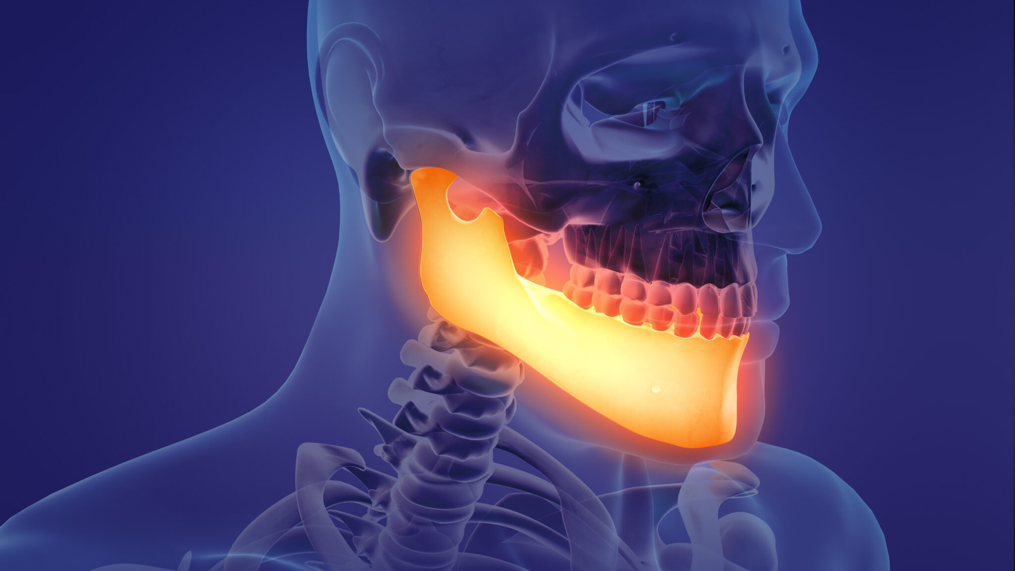 Compromised Tooth Preserving teeth to protect the jaw: Endodontic management of ...