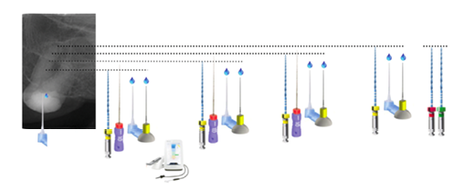 Rm Device In Instruments Conservative single-file reciprocating instrumentation of challenging ...