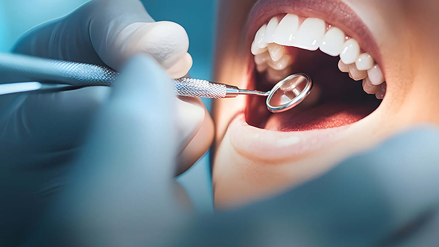 Close-up of a dentist examining a patient's open mouth with a dental mirror