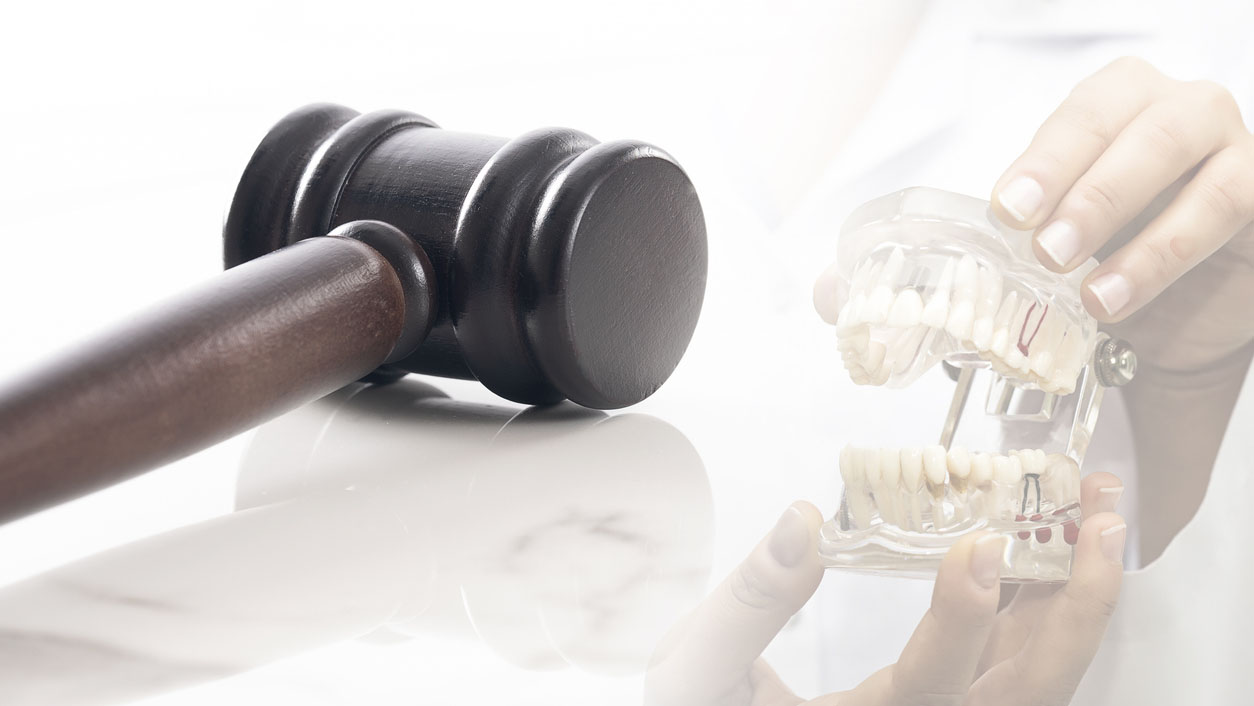 Align wins European patent ruling against Angelalign’s Torque Ridges